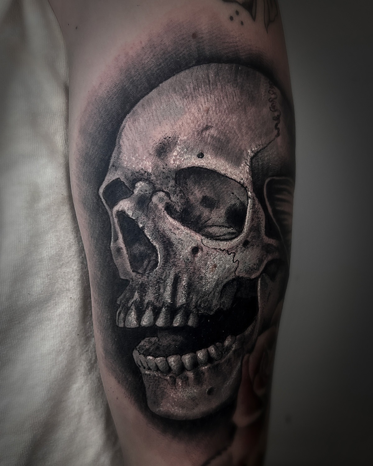 skull